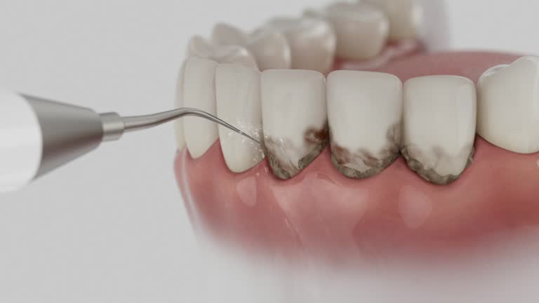 Reliable Dental contractor in New Carlisle, OH by Dentist Open Now